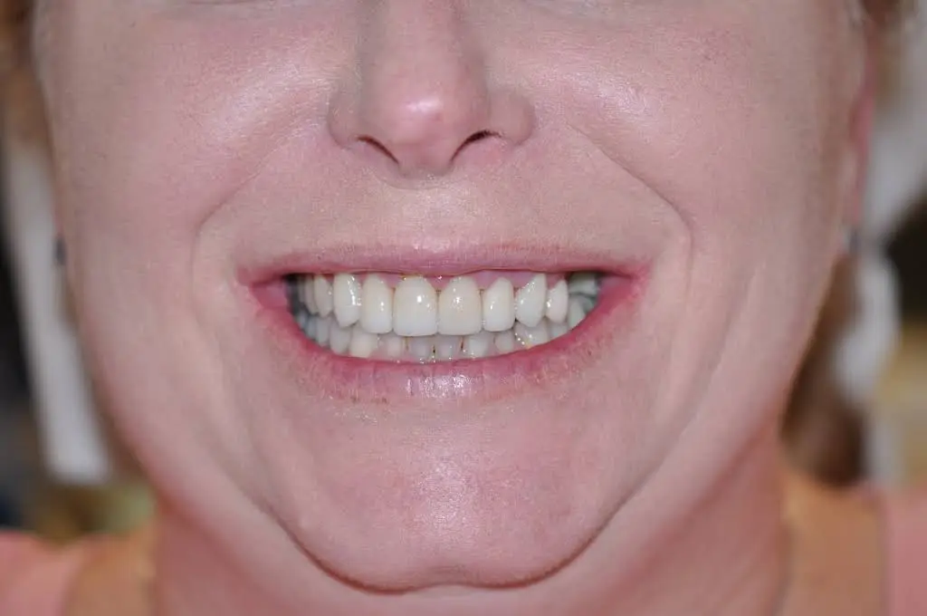 Willow Springs Dental