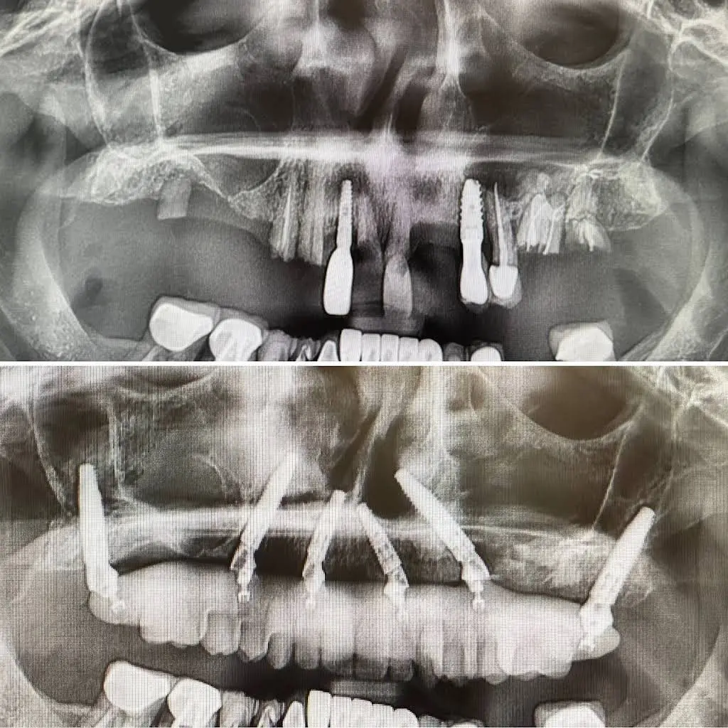 Makeover Dental