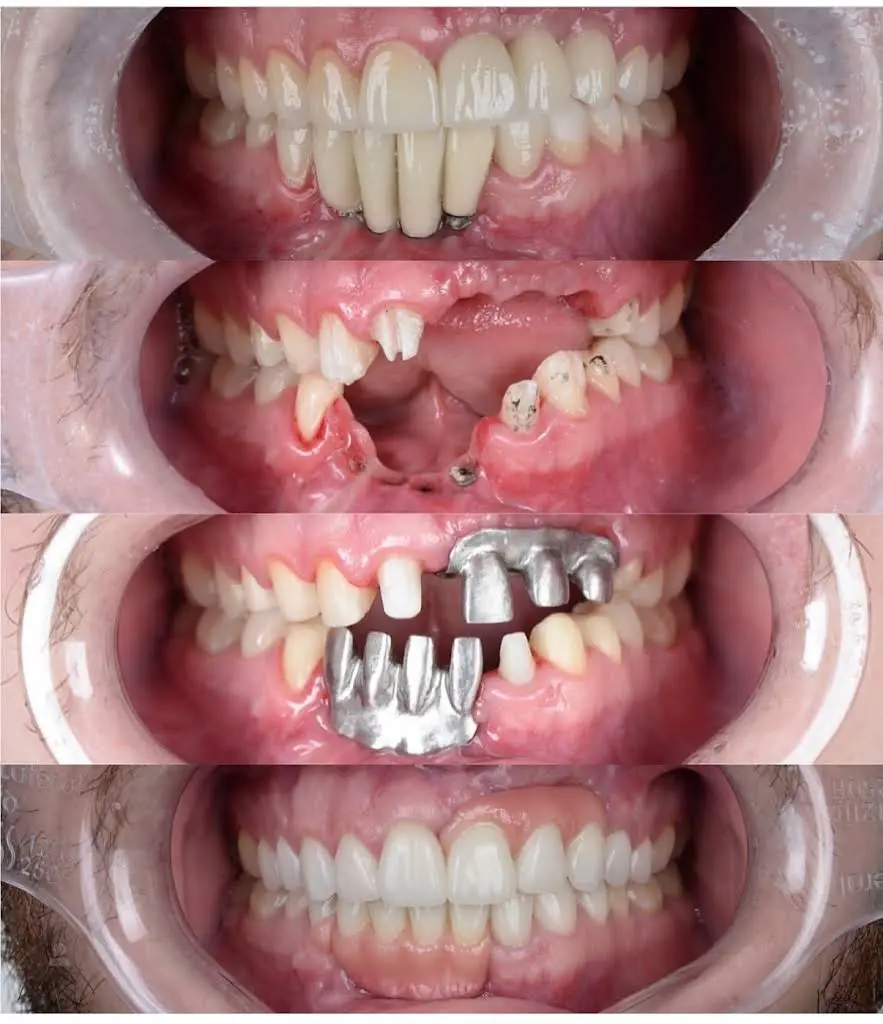 Makeover Dental