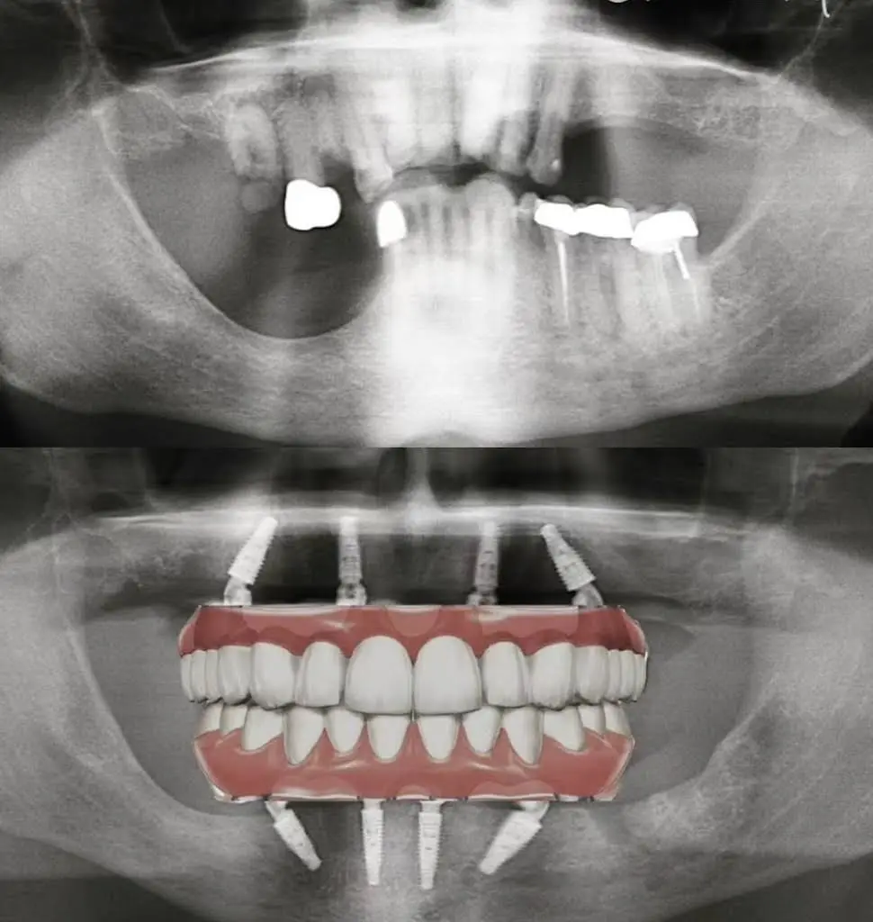 Makeover Dental