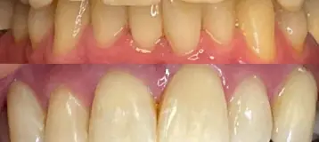 We Whiten