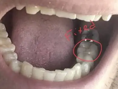 Silver Summit Dental