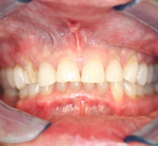 Nate Lewis DDS