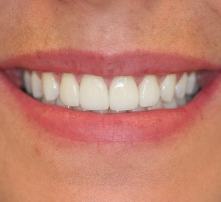 Nate Lewis DDS