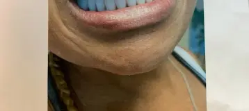 AApoLLo Dental Centers
