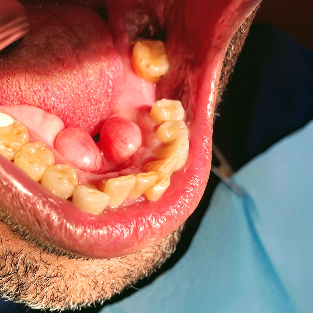 AApoLLo Dental Centers