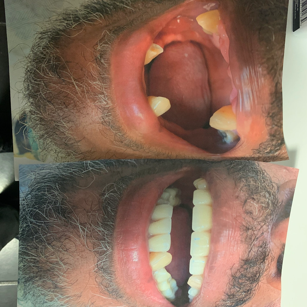 AApoLLo Dental Centers