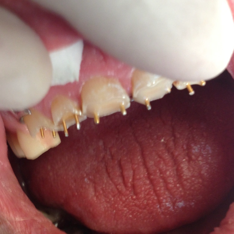 AApoLLo Dental Centers
