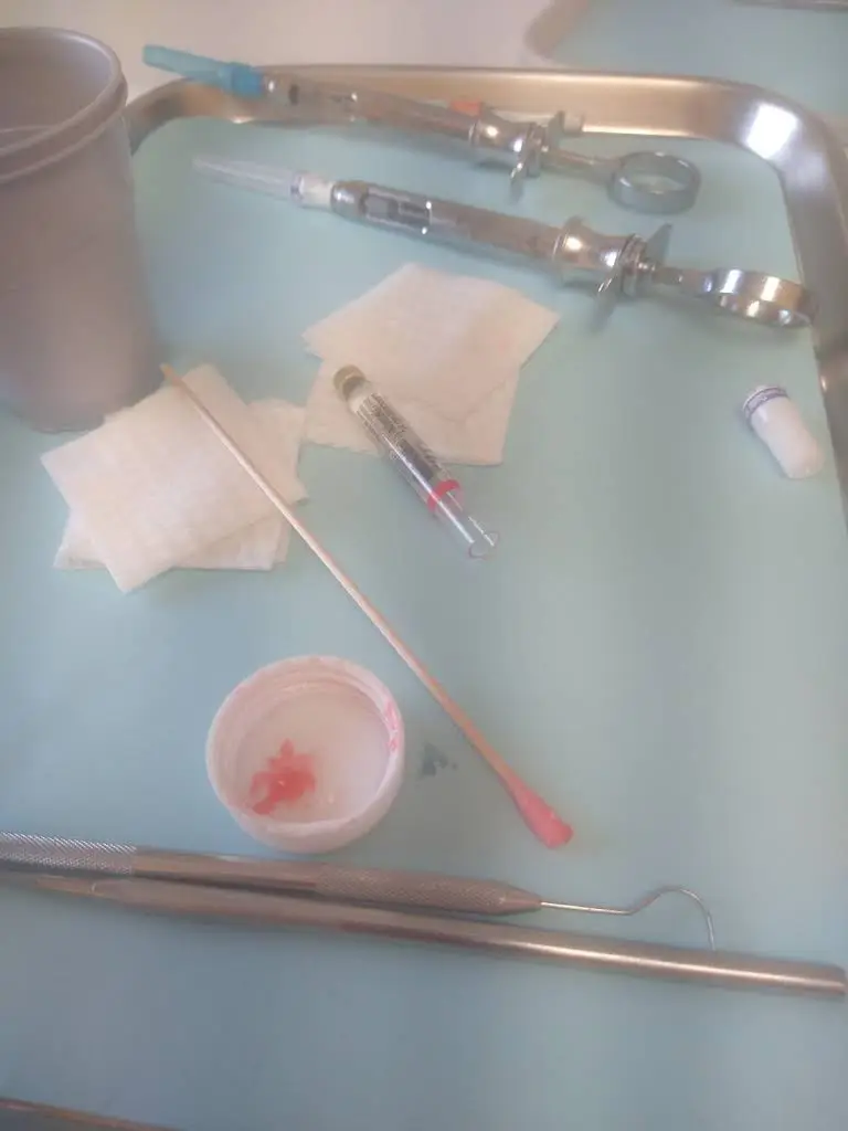 AApoLLo Dental Centers