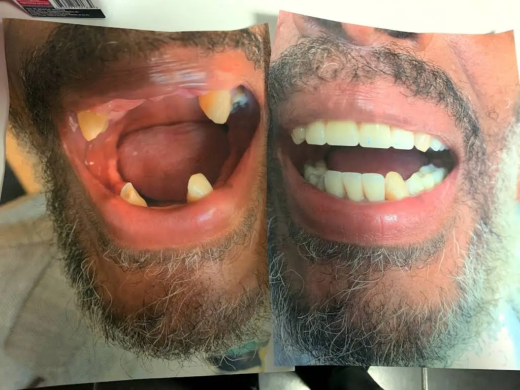 AApoLLo Dental Centers