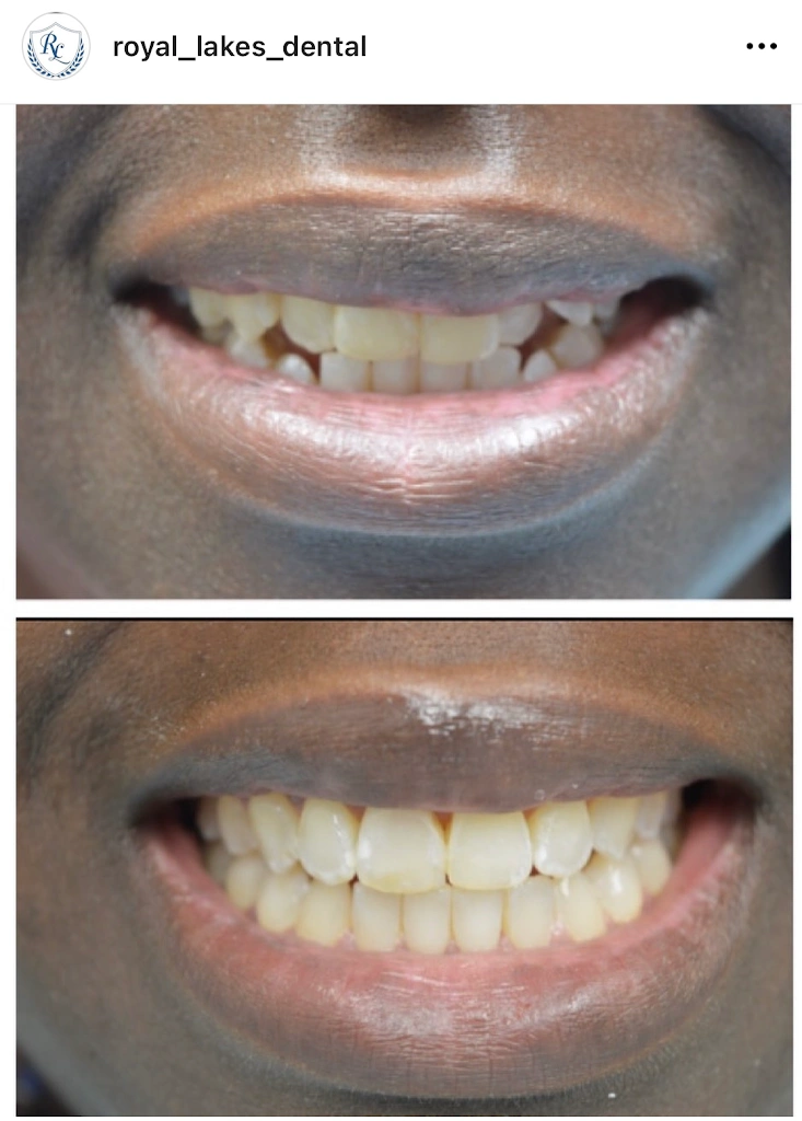 Royal Lakes Family Dental