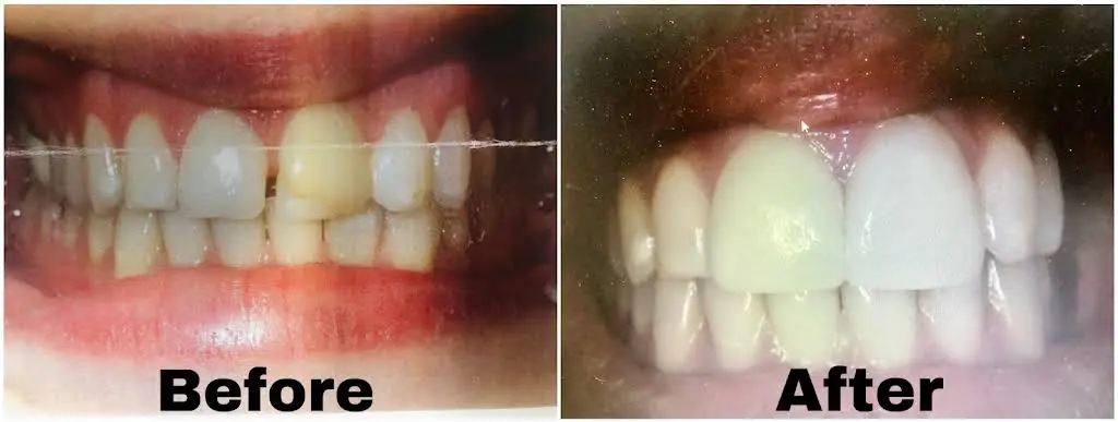 Smile Dental Works