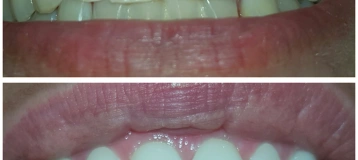 Ace Dental Center
