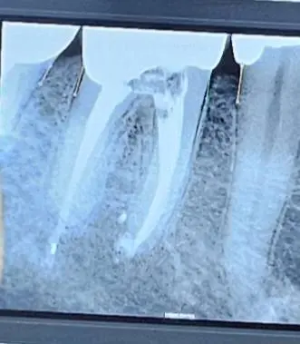 Hanover Dental
