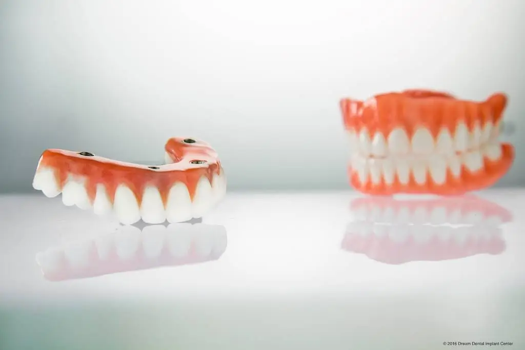 Dream Dental Implant Center