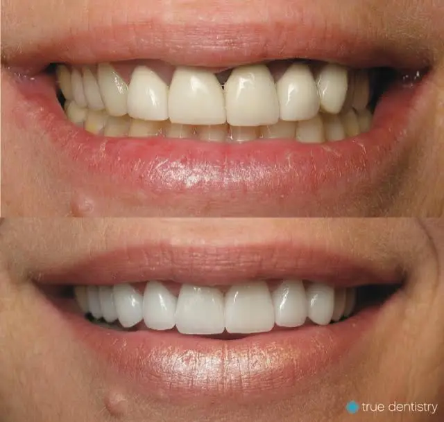 True Dentistry