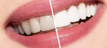 Inspire Dental of Summerlin