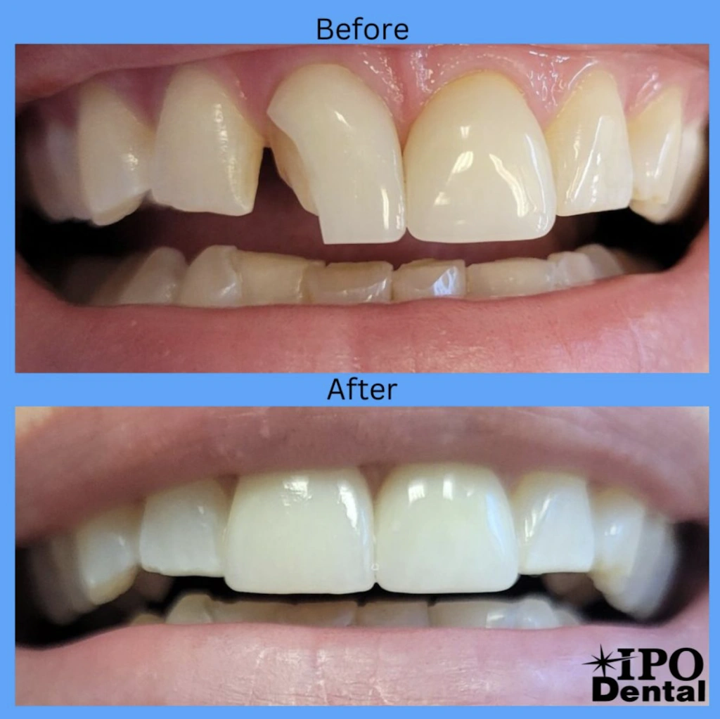 IPO Dental