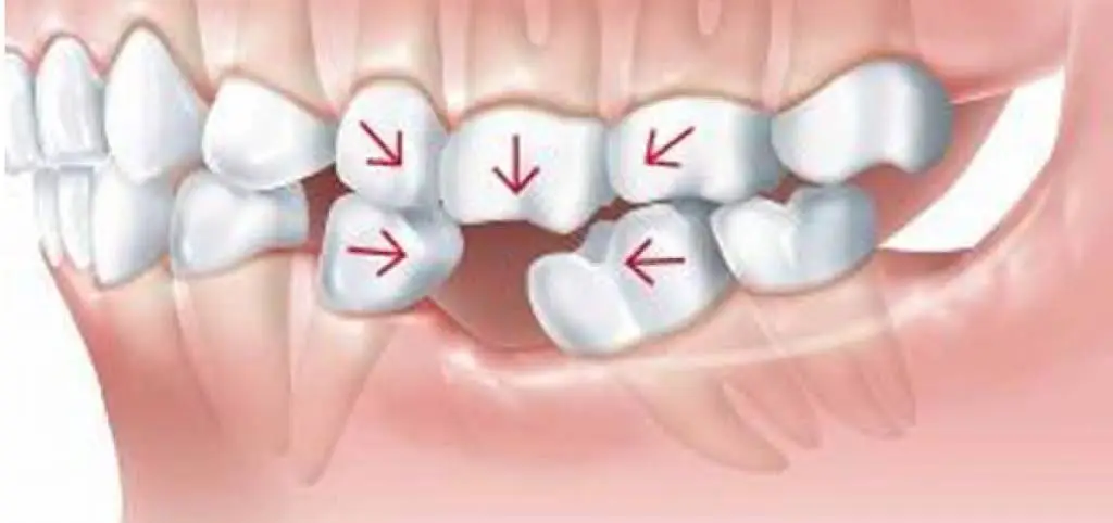 Salud Dental