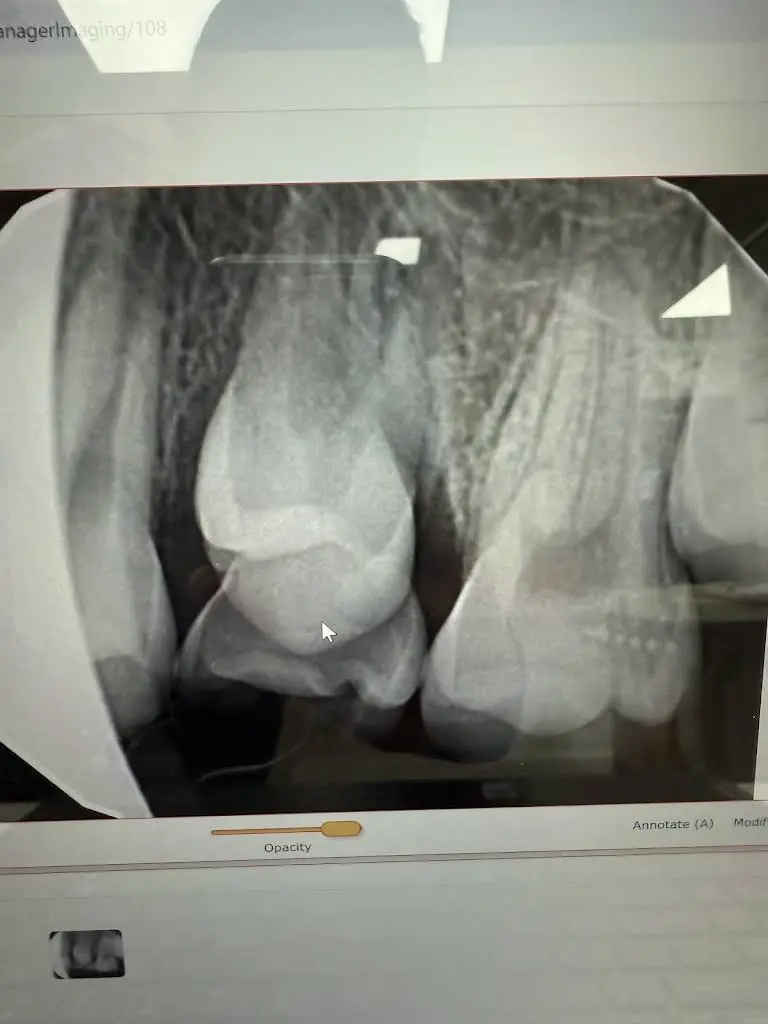 Weekend Dental Emergency Care