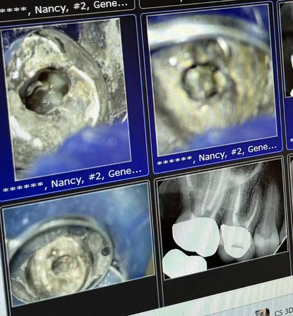 Modern Endodontics