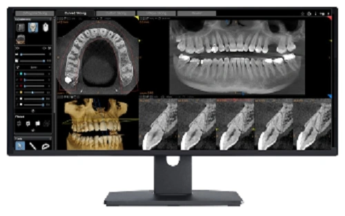 ChewsWisely Dental Implant Center