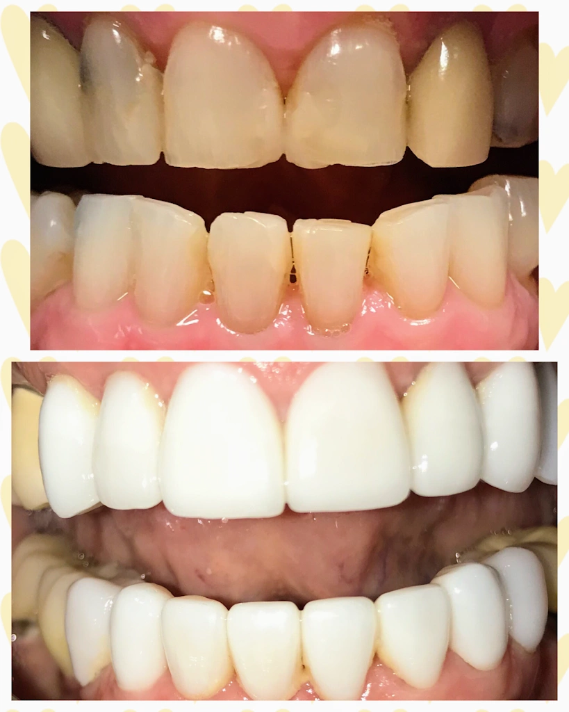 Downers Dental