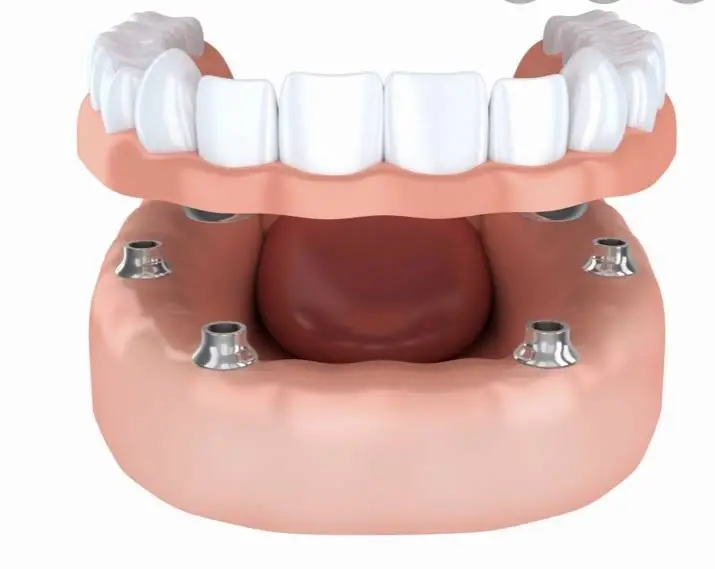 Downers Dental