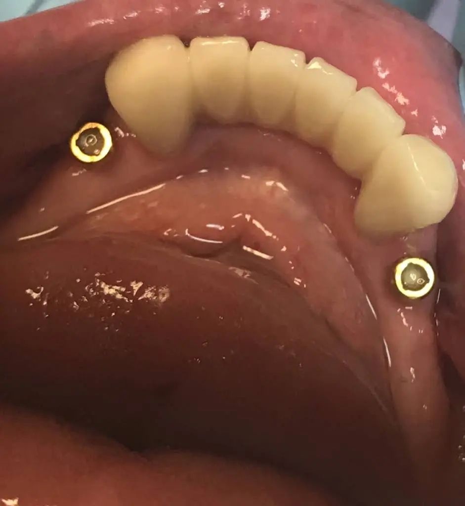 Downers Dental