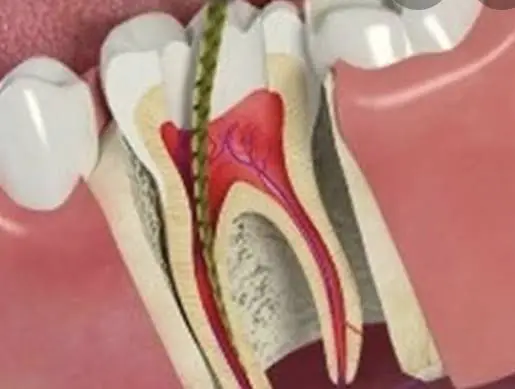 Downers Dental