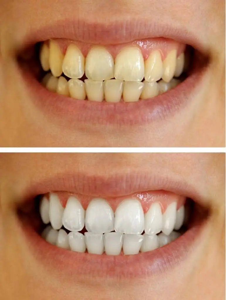 Delicate Dental