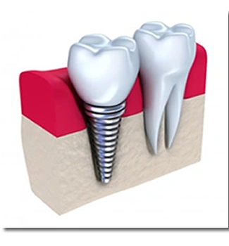 Advanced Dentistry