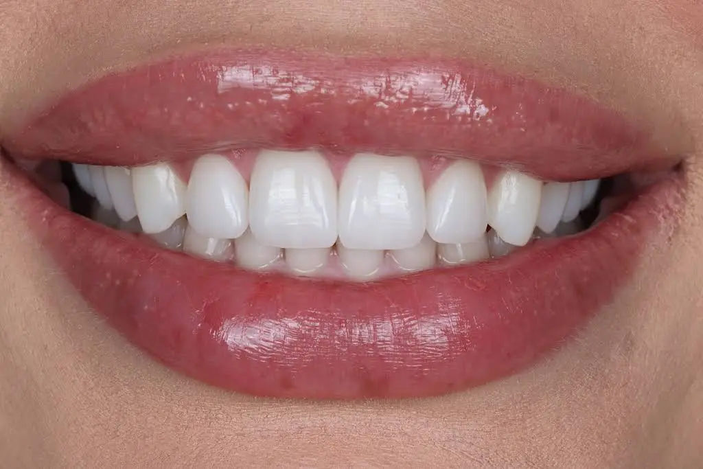 Stunning Smiles of Las Vegas