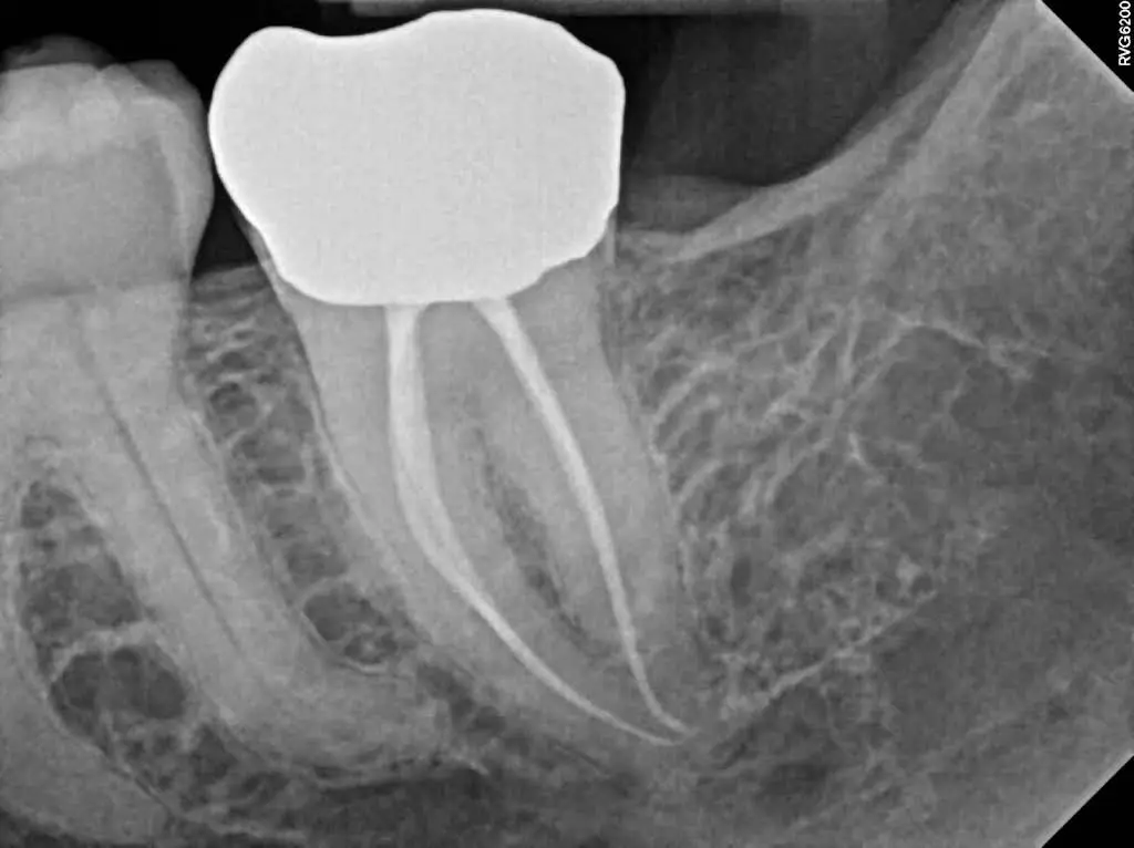 Red Rock Endodontics
