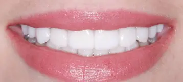 Elite Smiles by Walter Meden DDS
