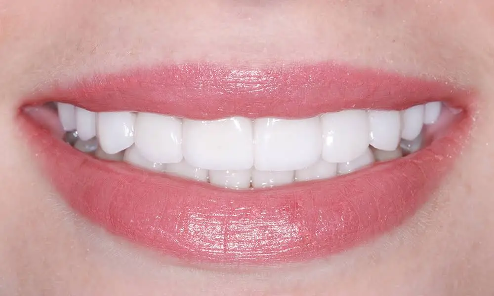 Elite Smiles by Walter Meden DDS