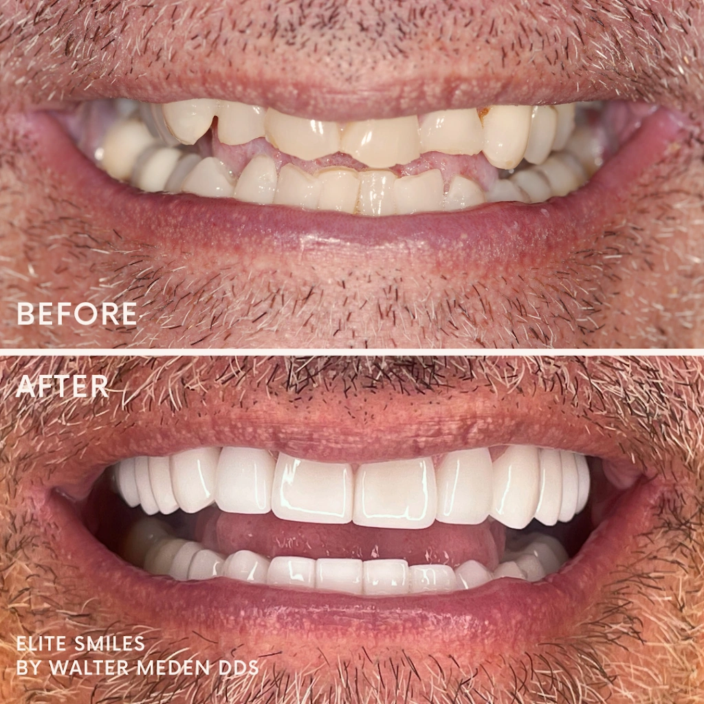 Elite Smiles by Walter Meden DDS