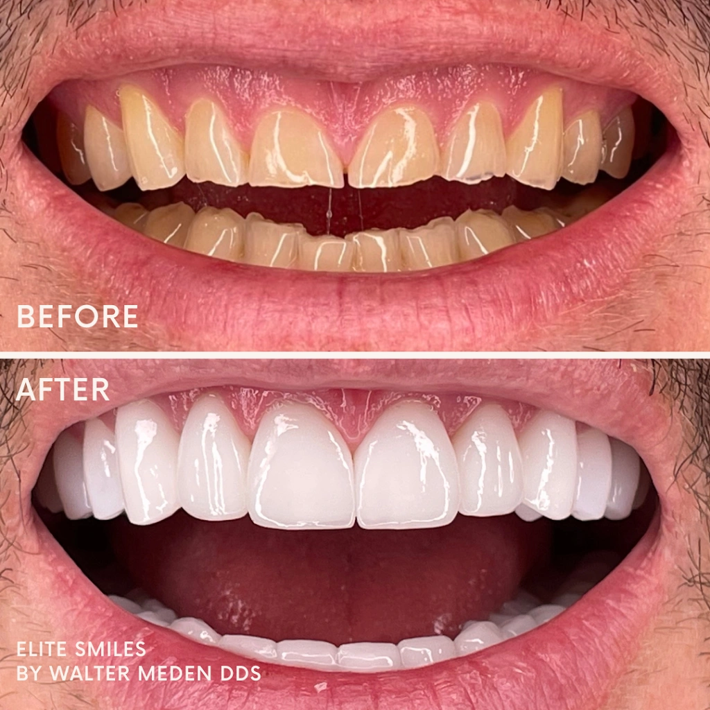 Elite Smiles by Walter Meden DDS