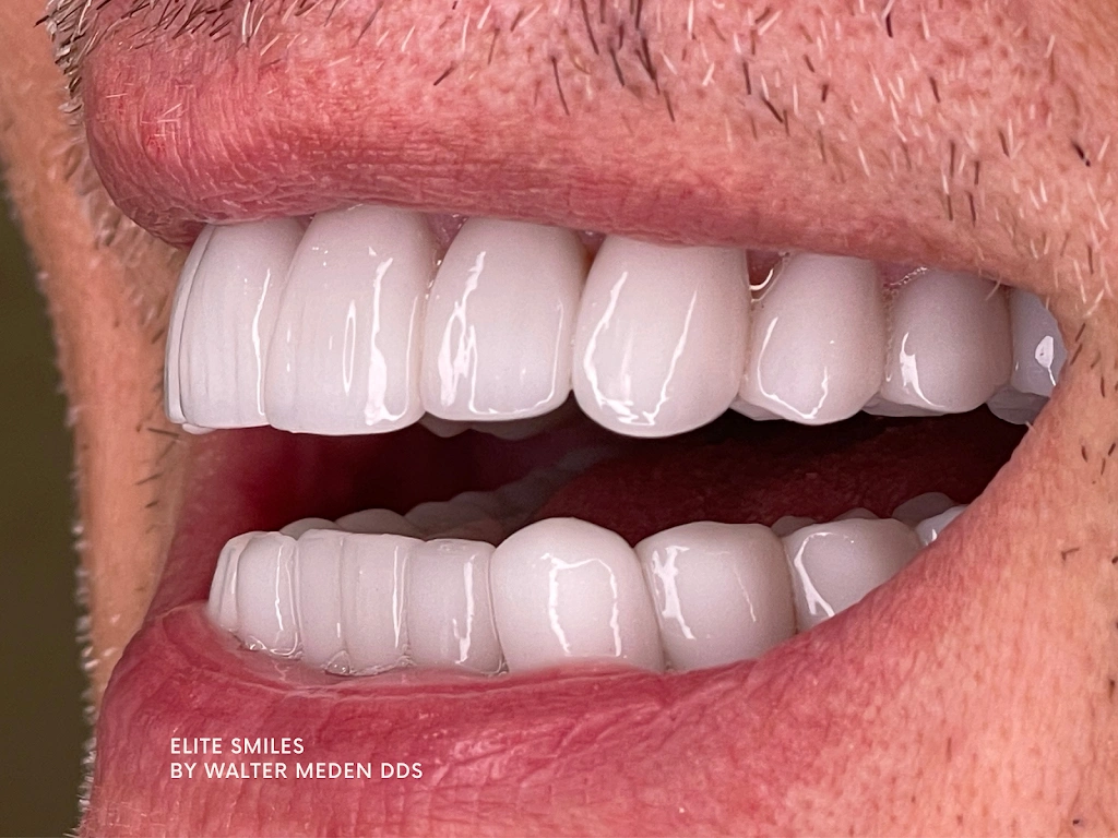 Elite Smiles by Walter Meden DDS