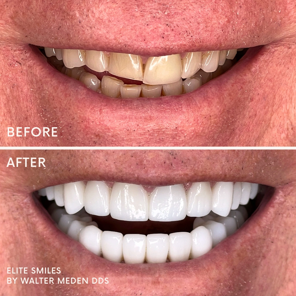 Elite Smiles by Walter Meden DDS