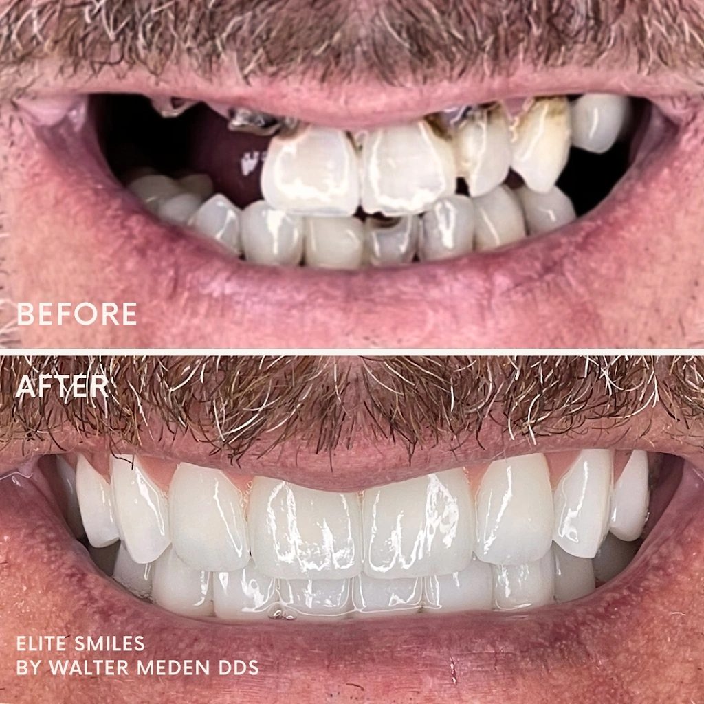 Elite Smiles by Walter Meden DDS