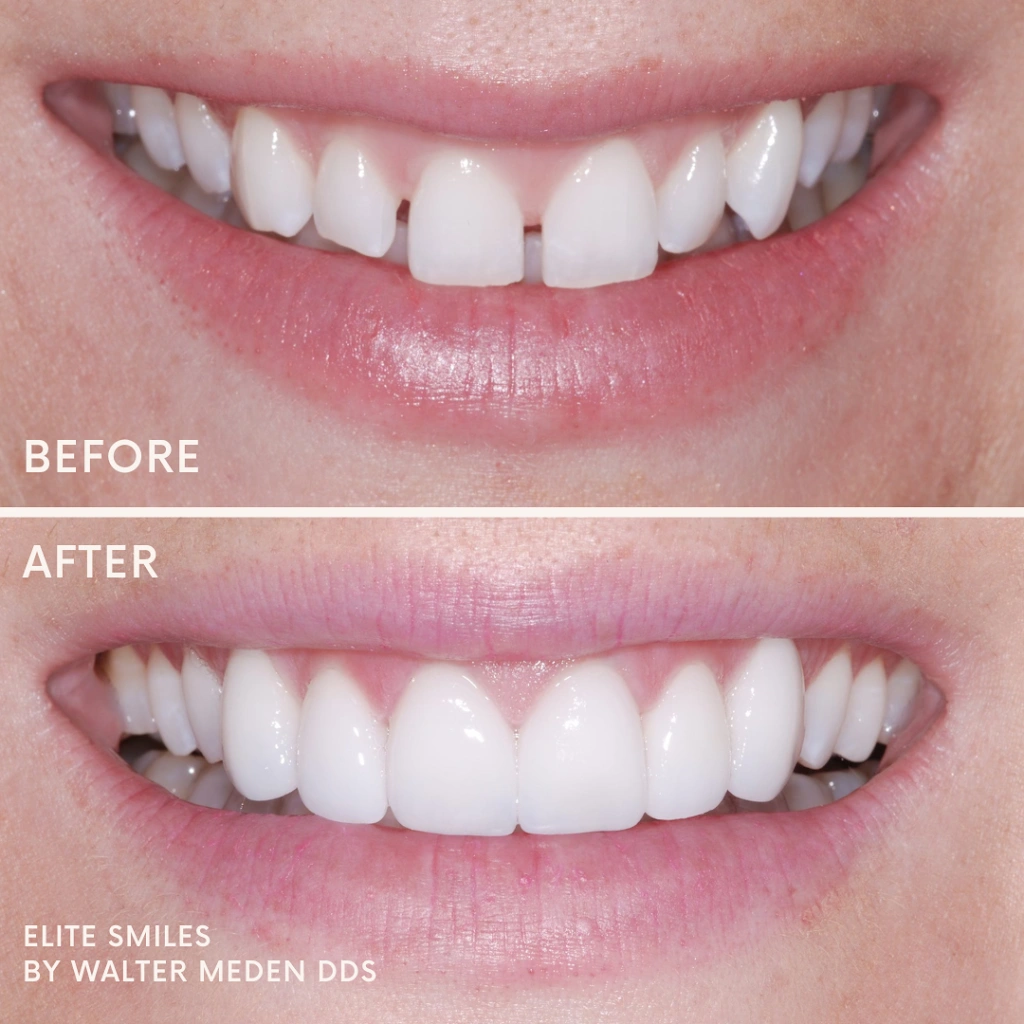 Elite Smiles by Walter Meden DDS