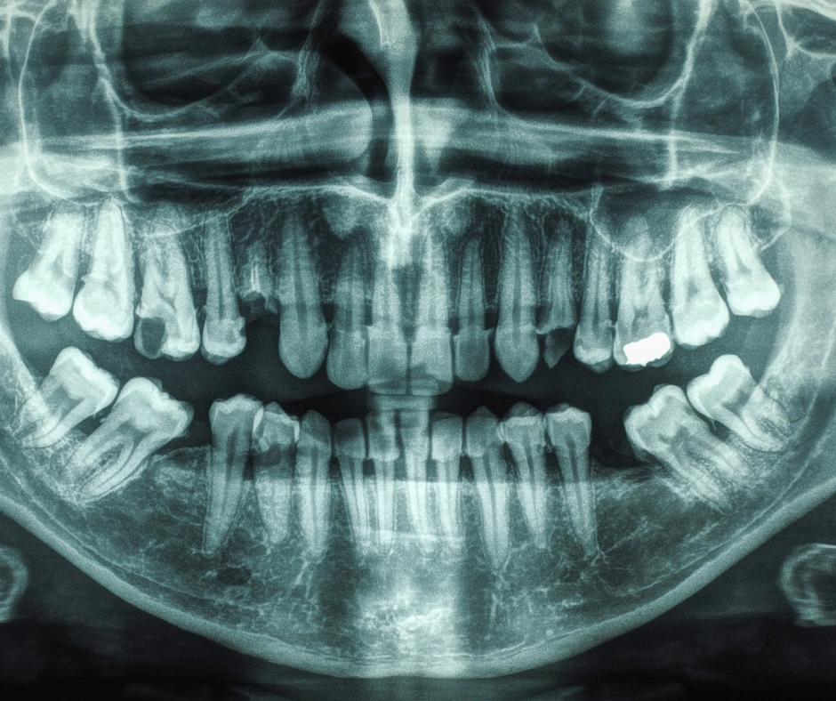 Chase Judd, DDS Family and Cosmetic Dentistry