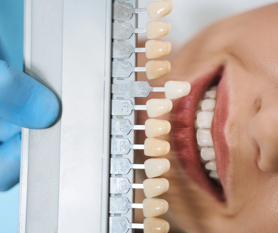 Chase Judd, DDS Family and Cosmetic Dentistry