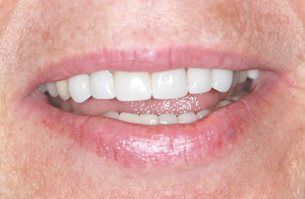 Granite View Dental