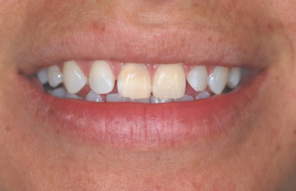 Granite View Dental