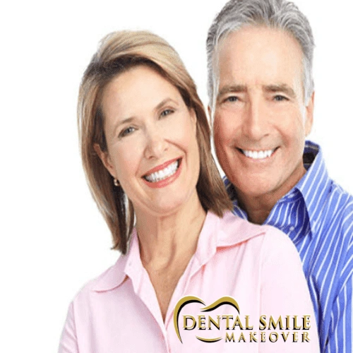 Dental Smile Makeover