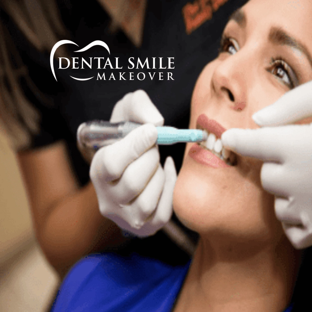 Dental Smile Makeover