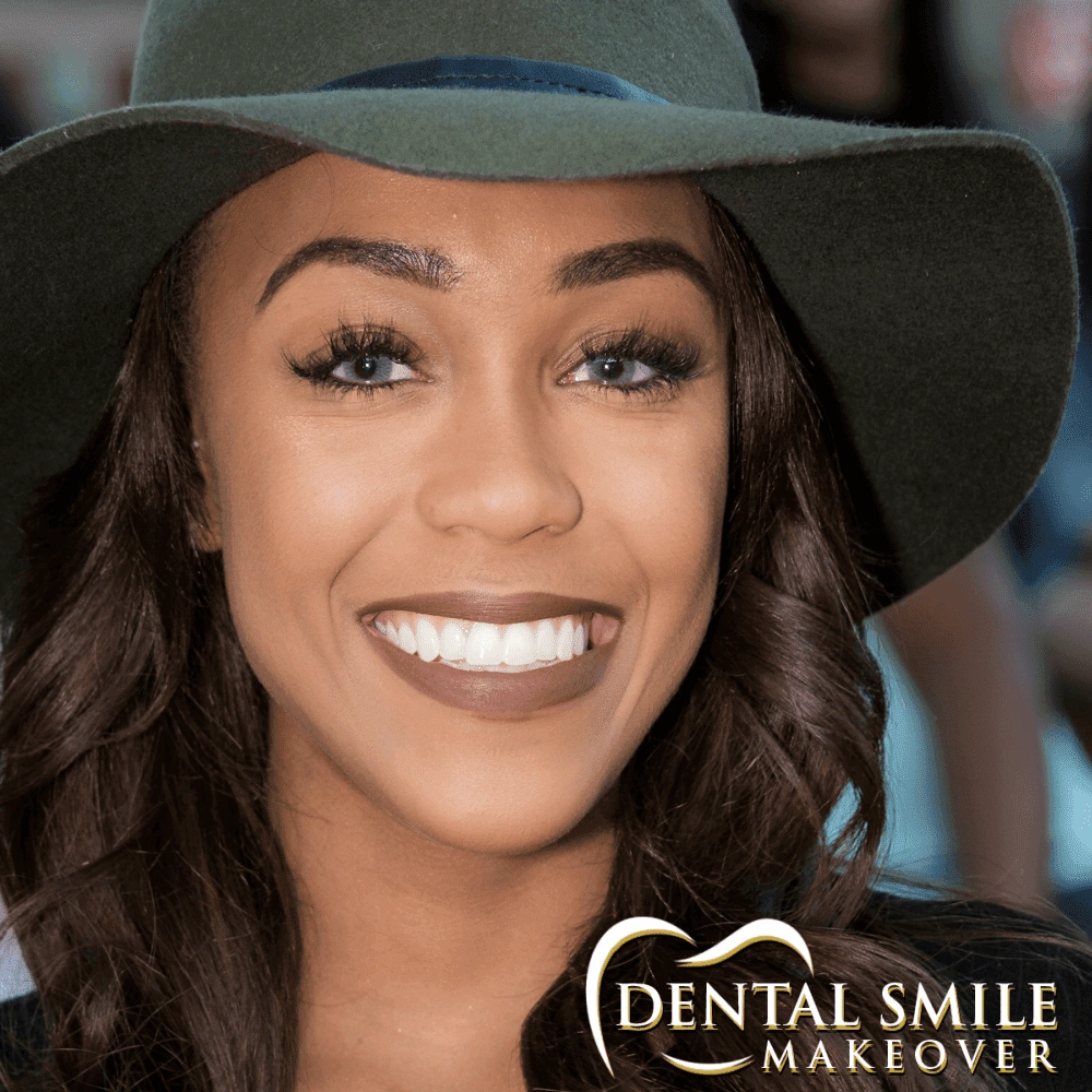 Dental Smile Makeover