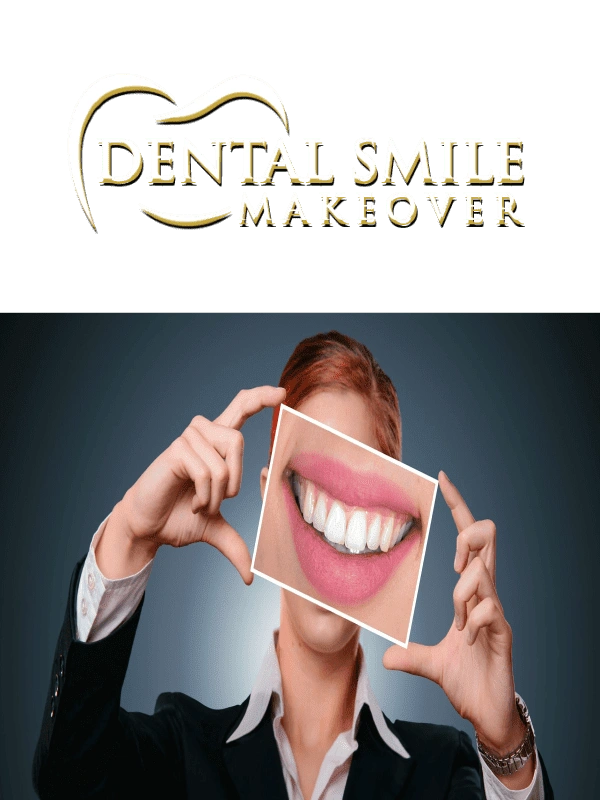 Dental Smile Makeover
